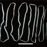 Cisticerkoza (finoza) goveda: fotografija, dijagnoza i liječenje