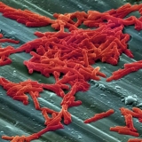 Klostridijum kod teladi i krava