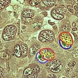 Kokcidioza kod pilića, pilića, brojlera