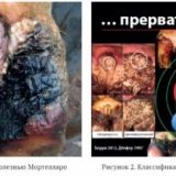 Liječenje bolesti kopita kod krava