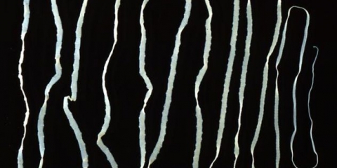 Cisticerkoza (finoza) goveda: fotografija, dijagnoza i liječenje