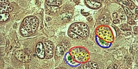 Kokcidioza kod pilića, pilića, brojlera