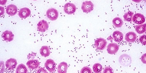 Pasteureloza svinja: simptomi i liječenje, fotografije